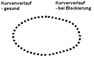 Abb. 1: Kurvenverlufe gesund - Blockierungen